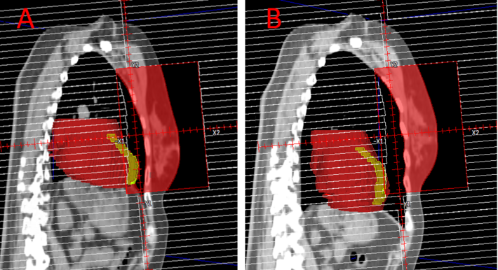 CT Thorax (© PD Dr. Christof Schäfer) Aufnahme einer CT Thorax